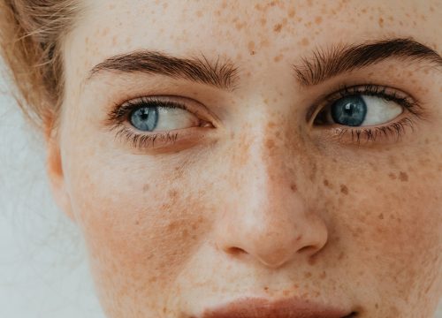 Photo of a woman's face with freckles