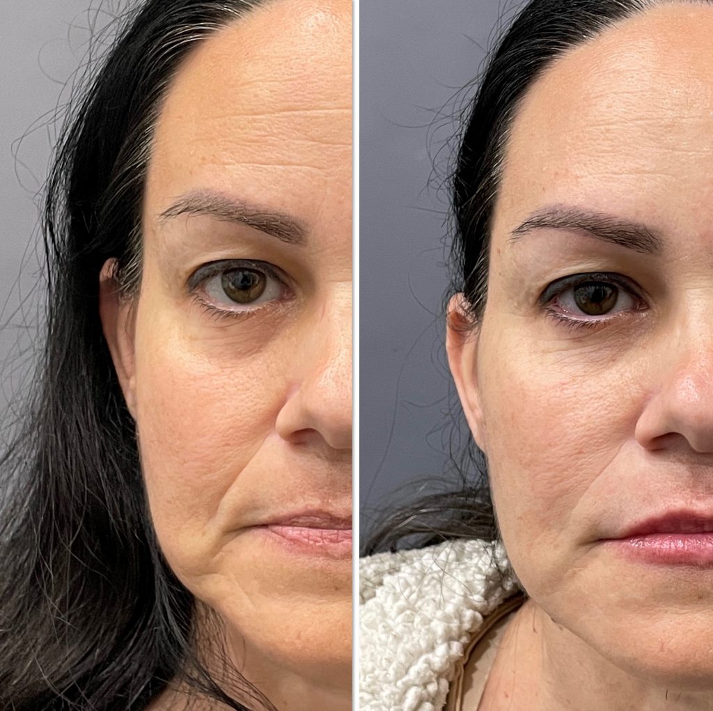 Before and after comprehensive treatment results